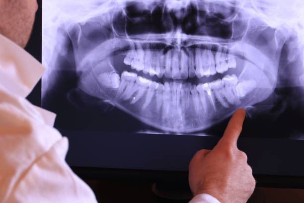 Best Emergency Treatment for Dental Infections or Abscesses in Barberton, OH