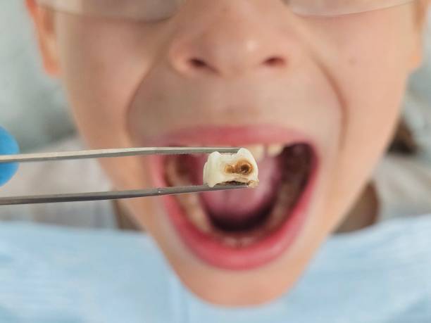 Best Emergency Gum Treatment in Barberton, OH